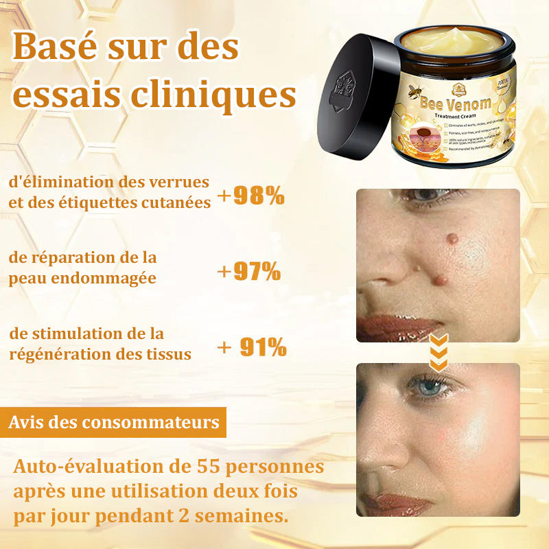 Turonu™ Venin d'abeille Crème réparatrice peau（Recommandé par dermatologue）👩‍⚕️