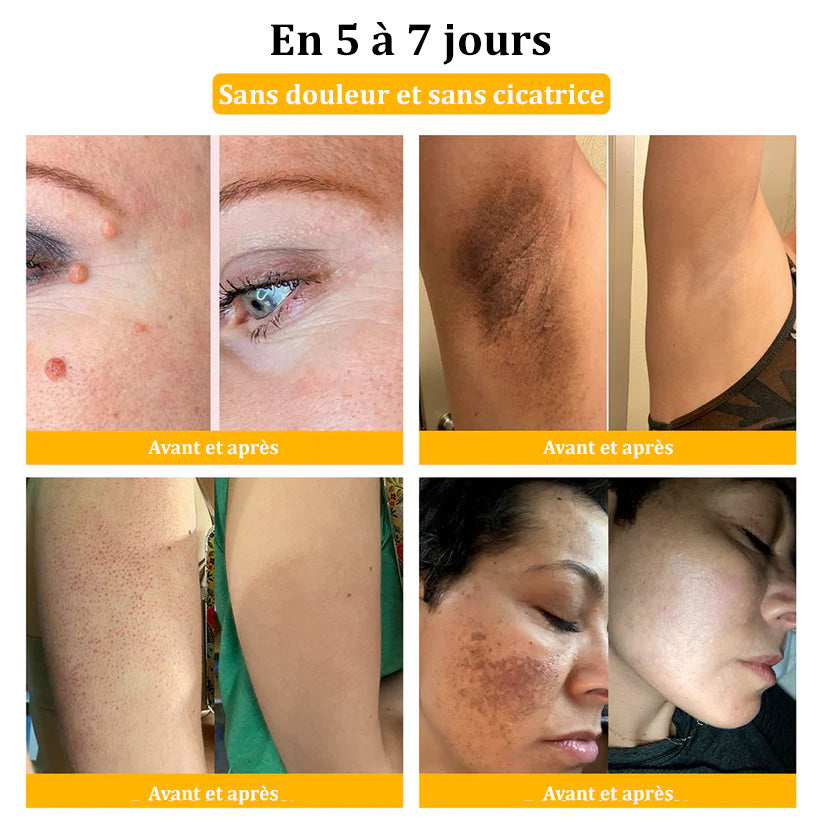 Turonu™ Venin d'abeille Crème réparatrice peau（Recommandé par dermatologue）👩‍⚕️