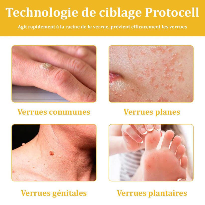 Turonu™ Venin d'abeille Crème réparatrice peau（Recommandé par dermatologue）👩‍⚕️