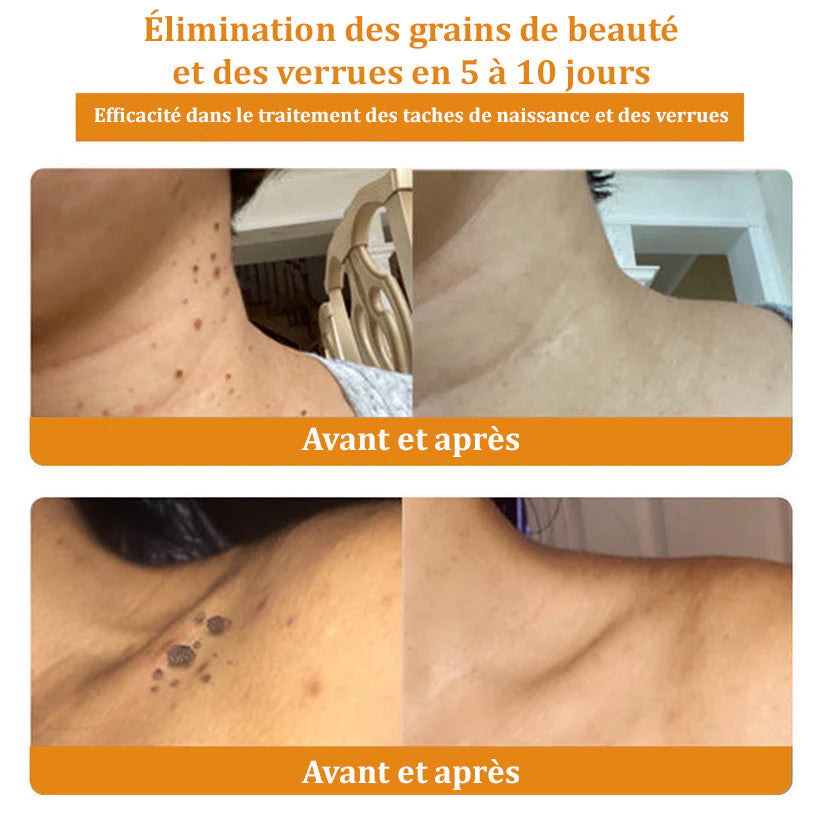 Turonu™ Venin d'abeille Crème réparatrice peau（Recommandé par dermatologue）👩‍⚕️