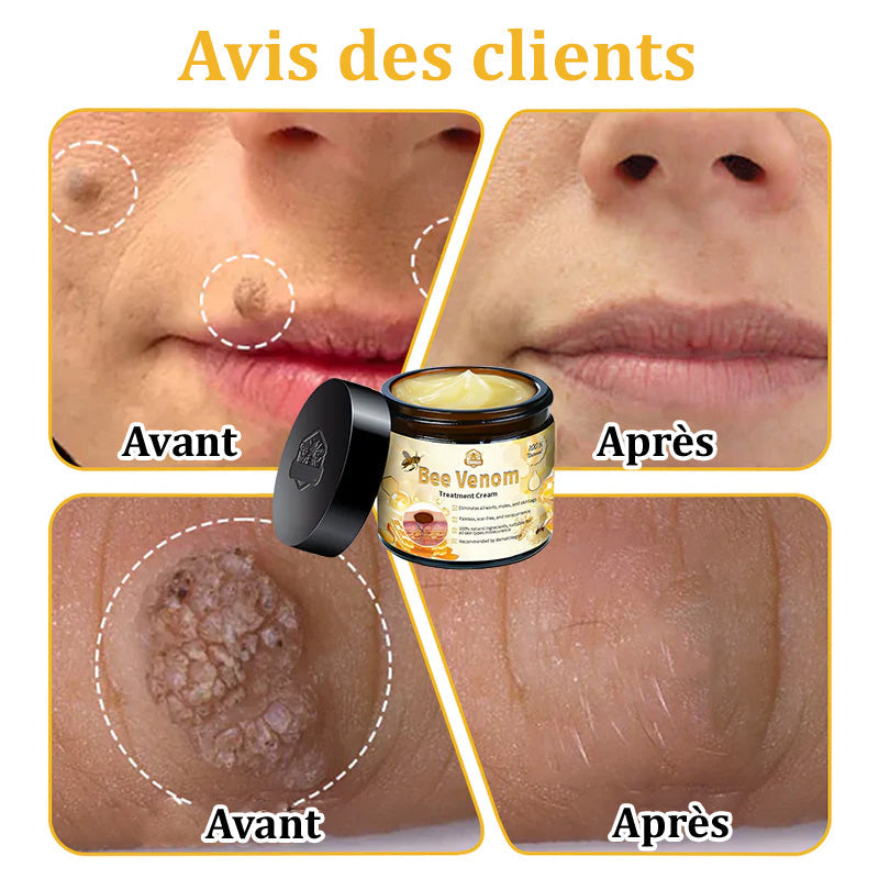 Turonu™ Venin d'abeille Crème réparatrice peau（Recommandé par dermatologue）👩‍⚕️