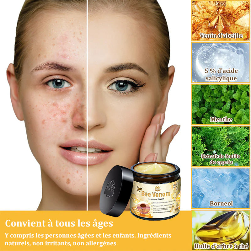 Turonu™ Venin d'abeille Crème réparatrice peau（Recommandé par dermatologue）👩‍⚕️