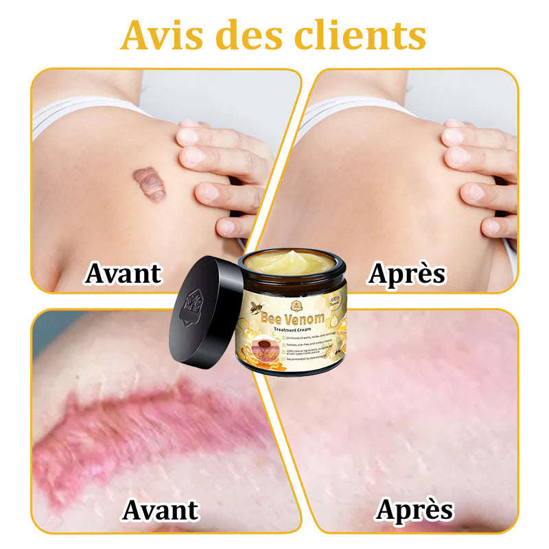 Turonu™ Venin d'abeille Crème réparatrice peau（Recommandé par dermatologue）👩‍⚕️